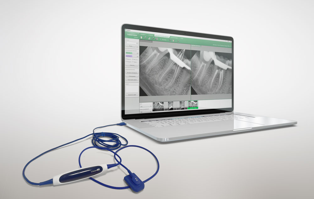 Радиовизиограф EzSensor soft Vatech