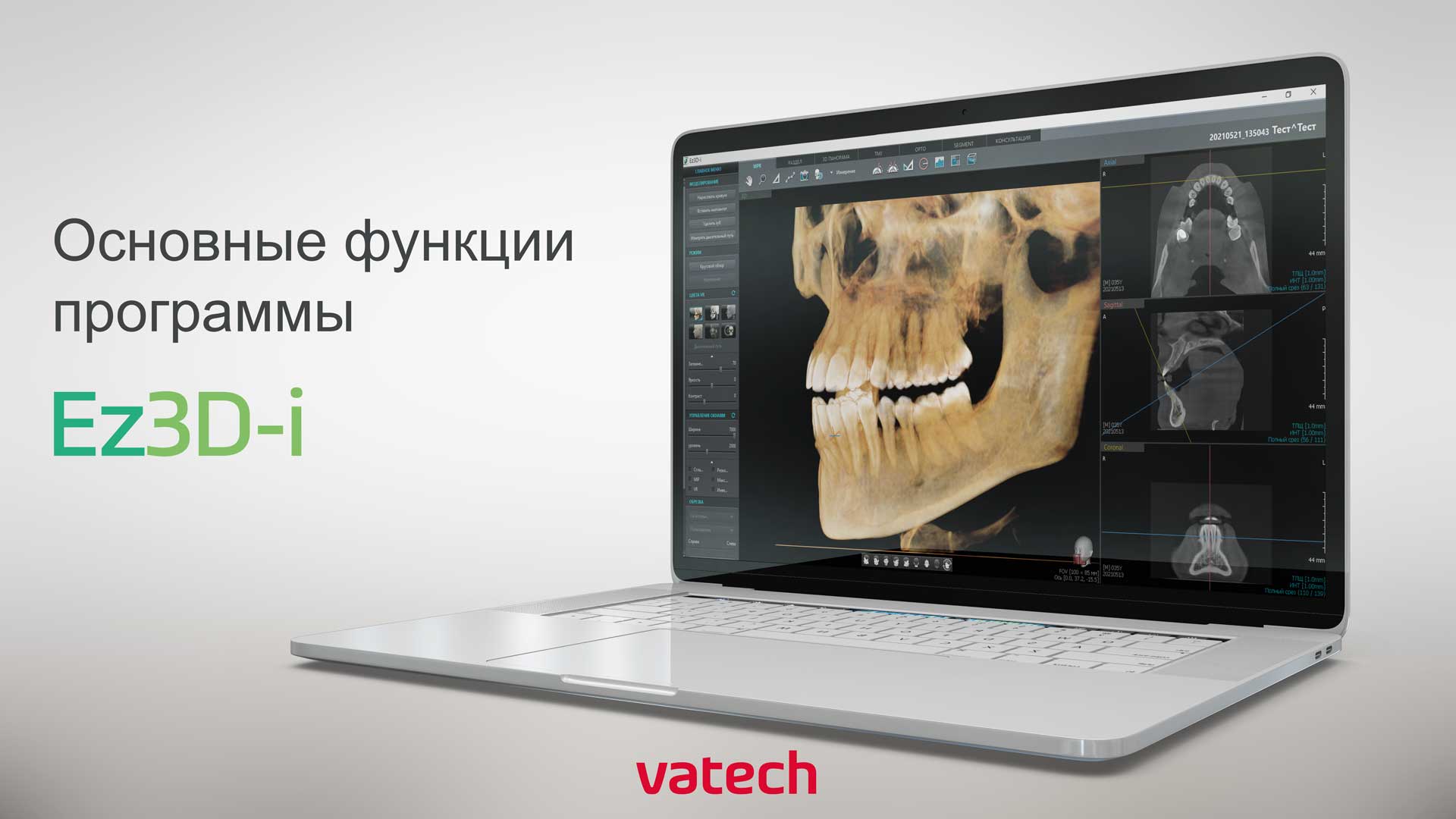 Ez3d2009. Ez3d-i. Томограф VATECH 3d. Ez3d Plus. VATECH кт.